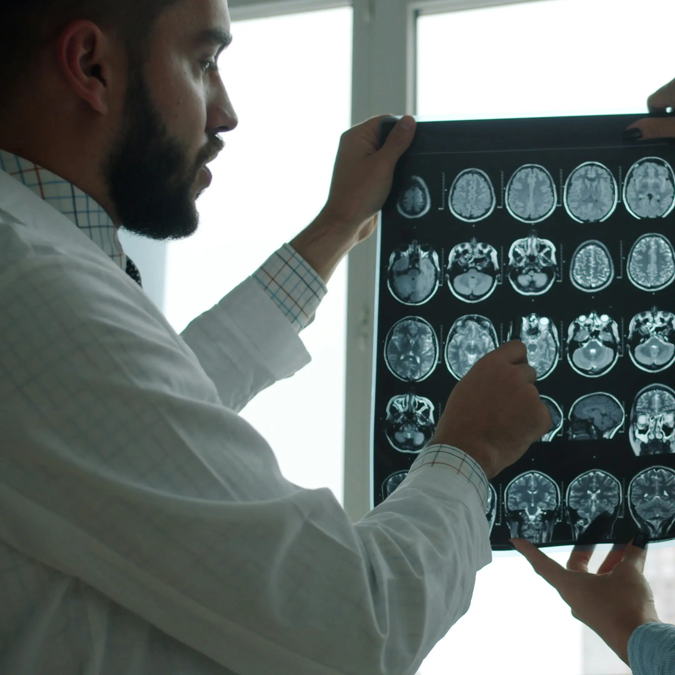 Arts houdt een scan van hersenbeelden omhoog en bespreekt deze met een ander.