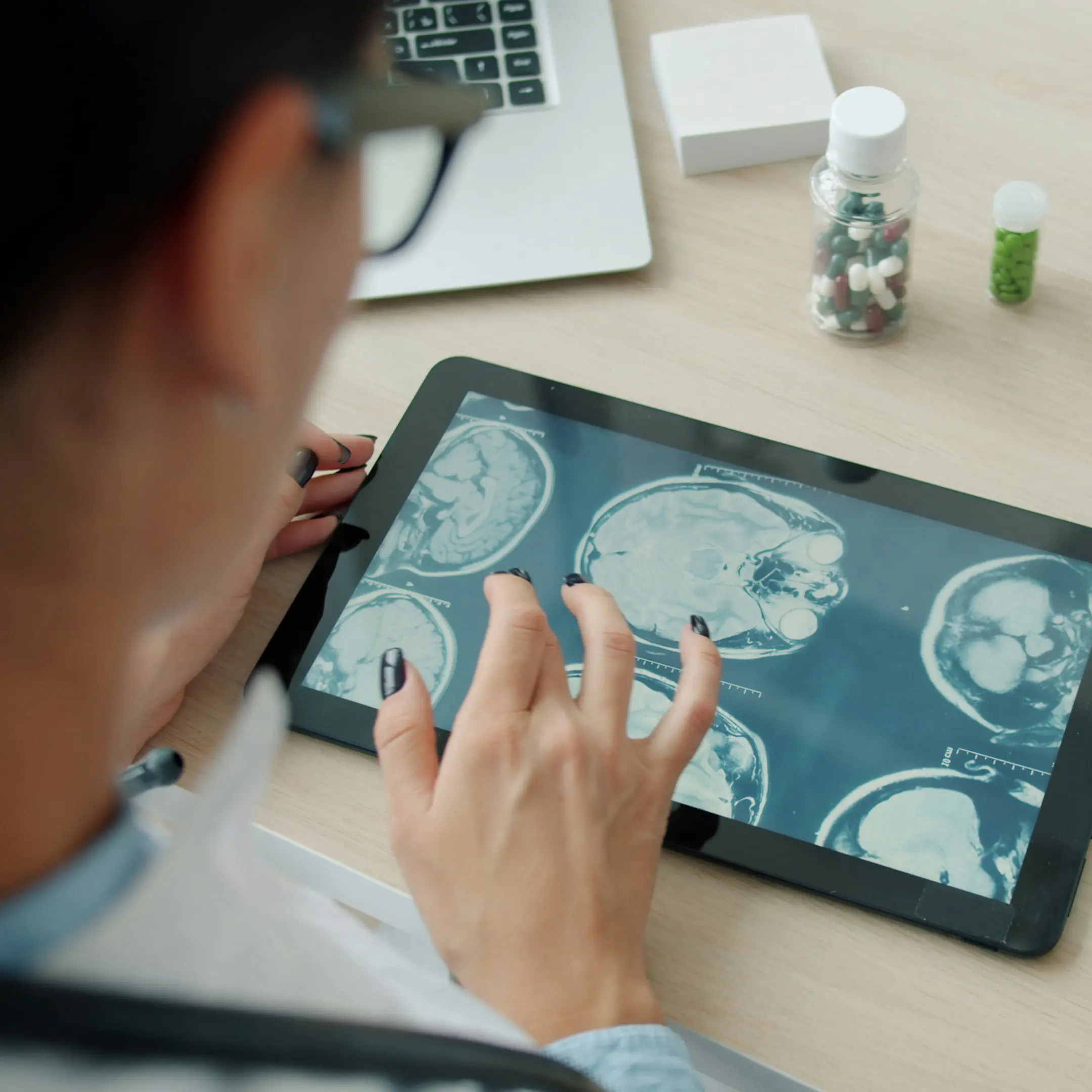 Persoon bekijkt MRI- of scanbeelden van hersenen op een tablet aan een bureau.